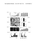 ANTI-HISTONE THERAPY FOR VASCULAR NECROSIS IN SEVERE GLOMERULONEPHRITIS diagram and image