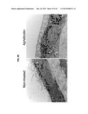 METHOD FOR GENERATING RETINAL PIGMENT EPITHELIUM (RPE) CELLS FROM INDUCED     PLURIPOTENT STEM CELLS (IPSCs) diagram and image