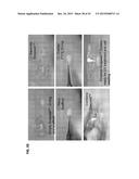 METHOD FOR GENERATING RETINAL PIGMENT EPITHELIUM (RPE) CELLS FROM INDUCED     PLURIPOTENT STEM CELLS (IPSCs) diagram and image