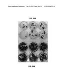 METHOD FOR GENERATING RETINAL PIGMENT EPITHELIUM (RPE) CELLS FROM INDUCED     PLURIPOTENT STEM CELLS (IPSCs) diagram and image