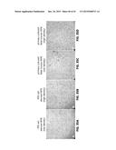 METHOD FOR GENERATING RETINAL PIGMENT EPITHELIUM (RPE) CELLS FROM INDUCED     PLURIPOTENT STEM CELLS (IPSCs) diagram and image