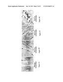 DIAGNOSTIC AND TREATMENT OF CHRONIC HEART FAILURE diagram and image