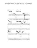 Hydraulic Delay Toe Valve System and Method diagram and image