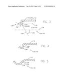 TURBOCHARGER COMPRESSOR NOISE REDUCTION SYSTEM AND METHOD diagram and image