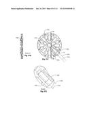 CONTINUOUSLY VARIABLE TRANSMISSION diagram and image