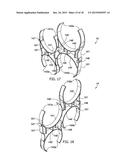 LOW EMF COMPACT DUCT SPACER diagram and image