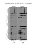 ANAPLASTIC LYMPHOMA KINASE IN KIDNEY CANCER diagram and image