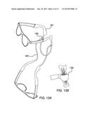 Eyeglass Retention Device diagram and image