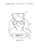 Eyeglass Retention Device diagram and image