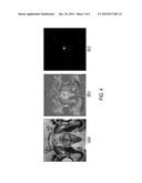 CORRELATED DIFFUSION IMAGING SYSTEM AND METHOD FOR IDENTIFICATION OF     BIOLOGICAL TISSUE OF INTEREST diagram and image