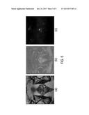 CORRELATED DIFFUSION IMAGING SYSTEM AND METHOD FOR IDENTIFICATION OF     BIOLOGICAL TISSUE OF INTEREST diagram and image