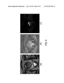 CORRELATED DIFFUSION IMAGING SYSTEM AND METHOD FOR IDENTIFICATION OF     BIOLOGICAL TISSUE OF INTEREST diagram and image