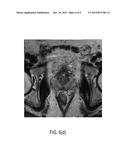 CORRELATED DIFFUSION IMAGING SYSTEM AND METHOD FOR IDENTIFICATION OF     BIOLOGICAL TISSUE OF INTEREST diagram and image