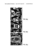 CORRELATED DIFFUSION IMAGING SYSTEM AND METHOD FOR IDENTIFICATION OF     BIOLOGICAL TISSUE OF INTEREST diagram and image