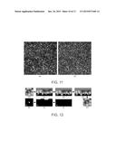 SEGMENTATION AND IDENTIFICATION OF CLOSED-CONTOUR FEATURES IN IMAGES USING     GRAPH THEORY AND QUASI-POLAR TRANSFORM diagram and image