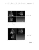 SYSTEMS AND METHODS FOR EXTENDING A FIELD OF VIEW OF MEDICAL IMAGES diagram and image