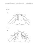 GARMENT HAVING DETACHABLE BACKPACK diagram and image