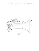 OTOSCOPE diagram and image