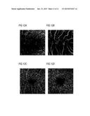 OPTICAL COHERENCE TOMOGRAPHY APPARATUS AND DATA PROCESSING PROGRAM diagram and image