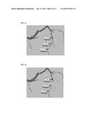 Method and System for Prediction of Post-Stenting Hemodynamic Metrics for     Treatment Planning of Arterial Stenosis diagram and image