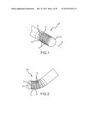 Flexible high-density mapping catheter tips and flexible ablation catheter     tips with onboard high-density mapping electrodes diagram and image