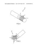 Flexible high-density mapping catheter tips and flexible ablation catheter     tips with onboard high-density mapping electrodes diagram and image