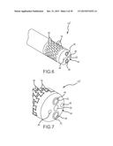 Flexible high-density mapping catheter tips and flexible ablation catheter     tips with onboard high-density mapping electrodes diagram and image