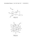 Flexible high-density mapping catheter tips and flexible ablation catheter     tips with onboard high-density mapping electrodes diagram and image