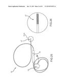 Flexible high-density mapping catheter tips and flexible ablation catheter     tips with onboard high-density mapping electrodes diagram and image