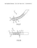 Flexible high-density mapping catheter tips and flexible ablation catheter     tips with onboard high-density mapping electrodes diagram and image