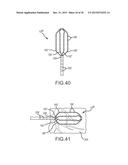 Flexible high-density mapping catheter tips and flexible ablation catheter     tips with onboard high-density mapping electrodes diagram and image