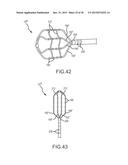 Flexible high-density mapping catheter tips and flexible ablation catheter     tips with onboard high-density mapping electrodes diagram and image