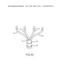 Flexible high-density mapping catheter tips and flexible ablation catheter     tips with onboard high-density mapping electrodes diagram and image