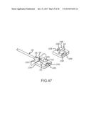 Flexible high-density mapping catheter tips and flexible ablation catheter     tips with onboard high-density mapping electrodes diagram and image