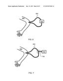 Methods and Apparatus for Rapid Monitoring of Hemostatic State diagram and image