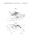 AUTOMATED VESSEL PUNCTURE DEVICE USING THREE-DIMENSIONAL(3D) NEAR INFRARED     (NIR) IMAGING AND A ROBOTICALLY DRIVEN NEEDLE diagram and image