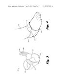 BABY FOOT STRAP diagram and image