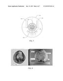 QUANTITATIVE TRANSMISSION ULTRASOUND IMAGING OF DENSE ANATOMICAL     STRUCTURES diagram and image