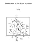 ULTRASONIC DIAGNOSTIC APPARATUS AND PROGRAM diagram and image