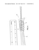 METHODS OF MAKING REINFORCED SOFT TISSUE GRAFTS WITH SUTURE LOOP/NEEDLE     CONSTRUCTS diagram and image