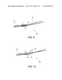 METHODS OF MAKING REINFORCED SOFT TISSUE GRAFTS WITH SUTURE LOOP/NEEDLE     CONSTRUCTS diagram and image