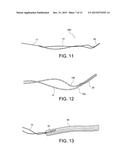 METHODS OF MAKING REINFORCED SOFT TISSUE GRAFTS WITH SUTURE LOOP/NEEDLE     CONSTRUCTS diagram and image