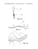 METHODS OF MAKING REINFORCED SOFT TISSUE GRAFTS WITH SUTURE LOOP/NEEDLE     CONSTRUCTS diagram and image