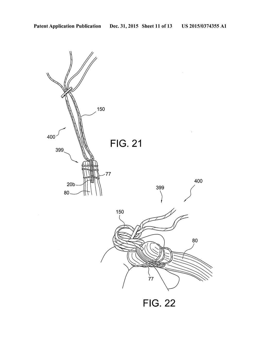 METHODS OF MAKING REINFORCED SOFT TISSUE GRAFTS WITH SUTURE LOOP/NEEDLE     CONSTRUCTS - diagram, schematic, and image 12