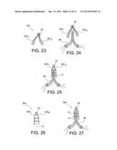 METHODS OF MAKING REINFORCED SOFT TISSUE GRAFTS WITH SUTURE LOOP/NEEDLE     CONSTRUCTS diagram and image