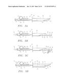 SUTURE APPARATUS, SYSTEM AND METHOD diagram and image