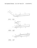 SUTURE APPARATUS, SYSTEM AND METHOD diagram and image