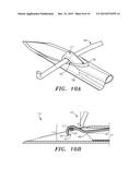 SUTURE APPARATUS, SYSTEM AND METHOD diagram and image