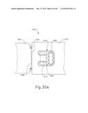 JAW OPENING FEATURE FOR SURGICAL STAPLER diagram and image