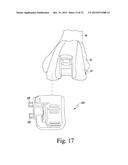 CUSTOMIZED PATIENT-SPECIFIC REVISION SURGICAL INSTRUMENTS AND METHOD diagram and image